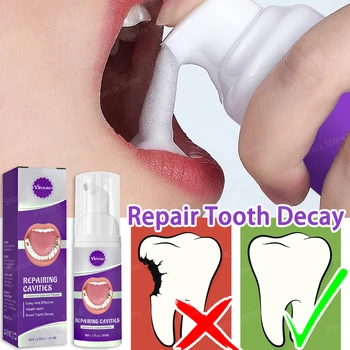 Zubný Kaz Sérum prevencii Zubného Kazu Chrániť Zuby Odstrániť Plak Ústne Čistenie Prírodný Bylinný Extrakt 30ml